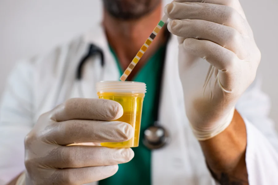 Urinary tract infections: correct sampling and correct treatment