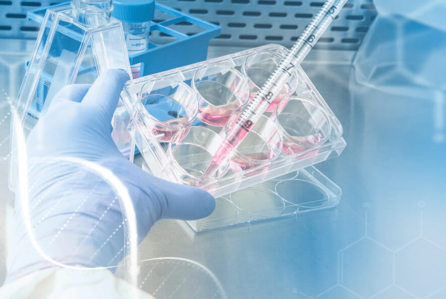 Κυστική Ίνωση – Ινοκυστική Νόσος