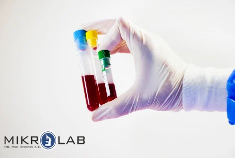 What is a complete blood count?