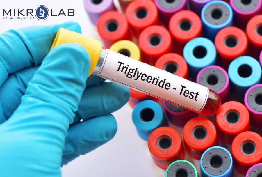 Triglycerides: What They Are, Normal Levels and How to Lower Them