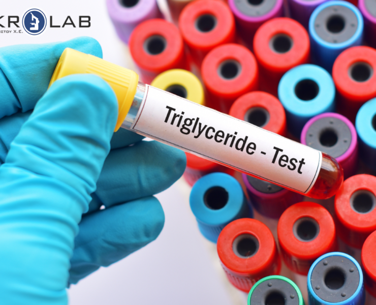 Τριγλυκερίδια – φυσιολογικές τιμές και μείωση