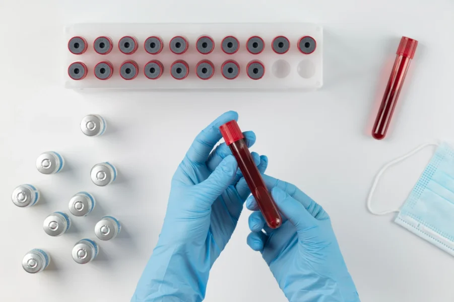 Blood Tests