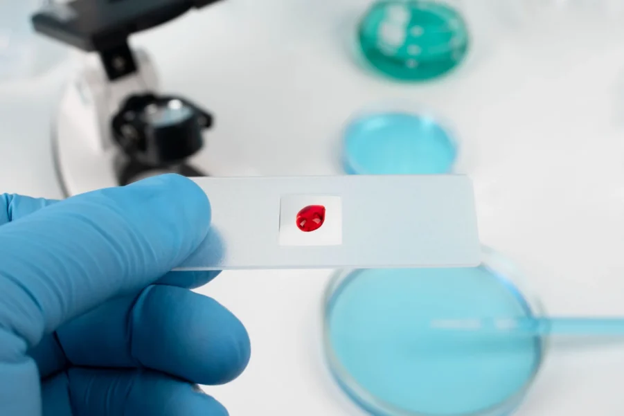 Immunology Tests