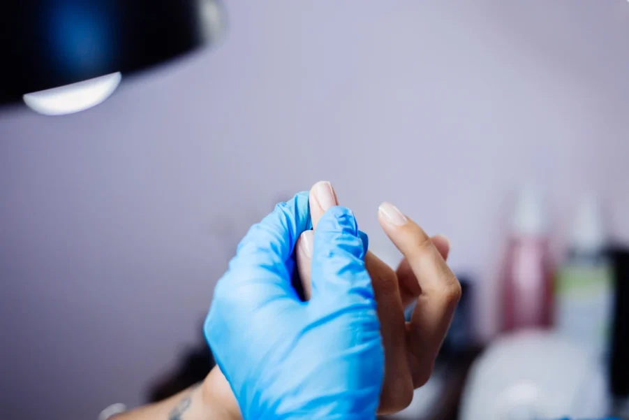 Skin and Nail Fungal Cultures – Onychomycosis