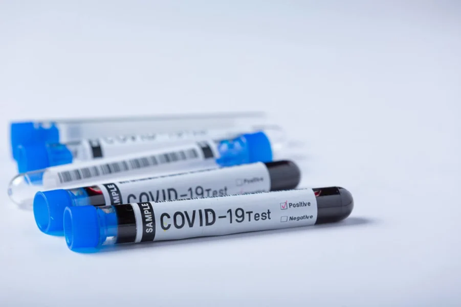 Fast PCR Covid-19 test