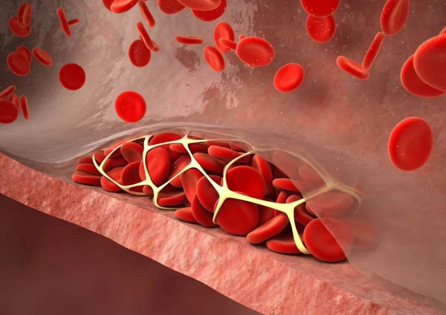 Thrombophilia